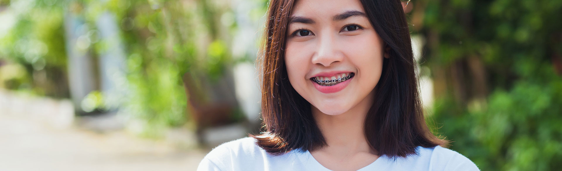 A teen wearing braces, showcasing comprehensive orthodontic care for proper teeth alignment.