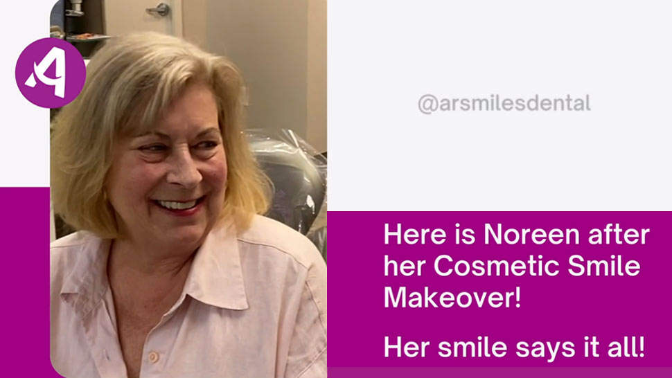 Noreen's Smile makeover
