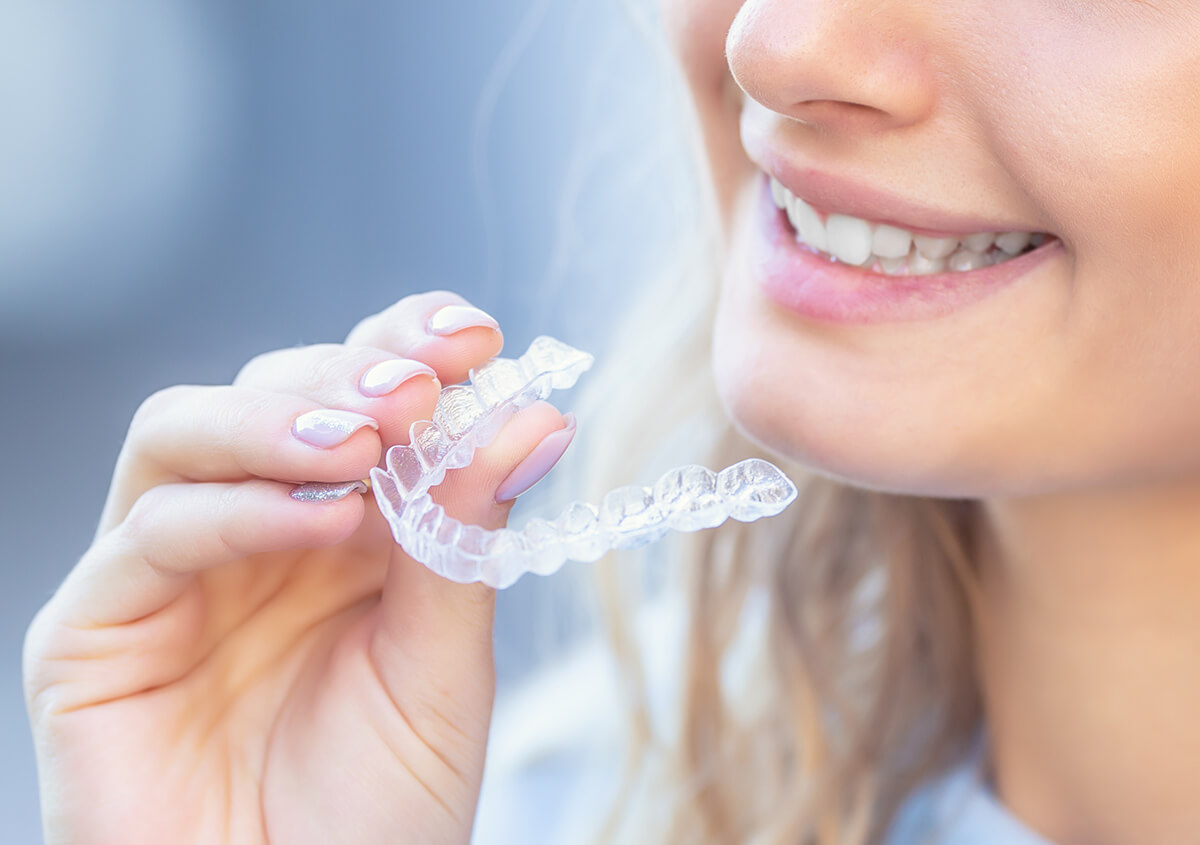 Clear Aligners for Teeth in Fairlawn OH Area