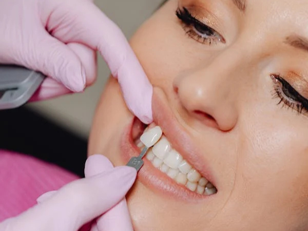 a dentist comparing veneer shade to patient's natural teeth