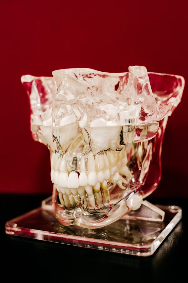 a transparent model of a skull with the jaw  showing a set of teeth with a dental implant