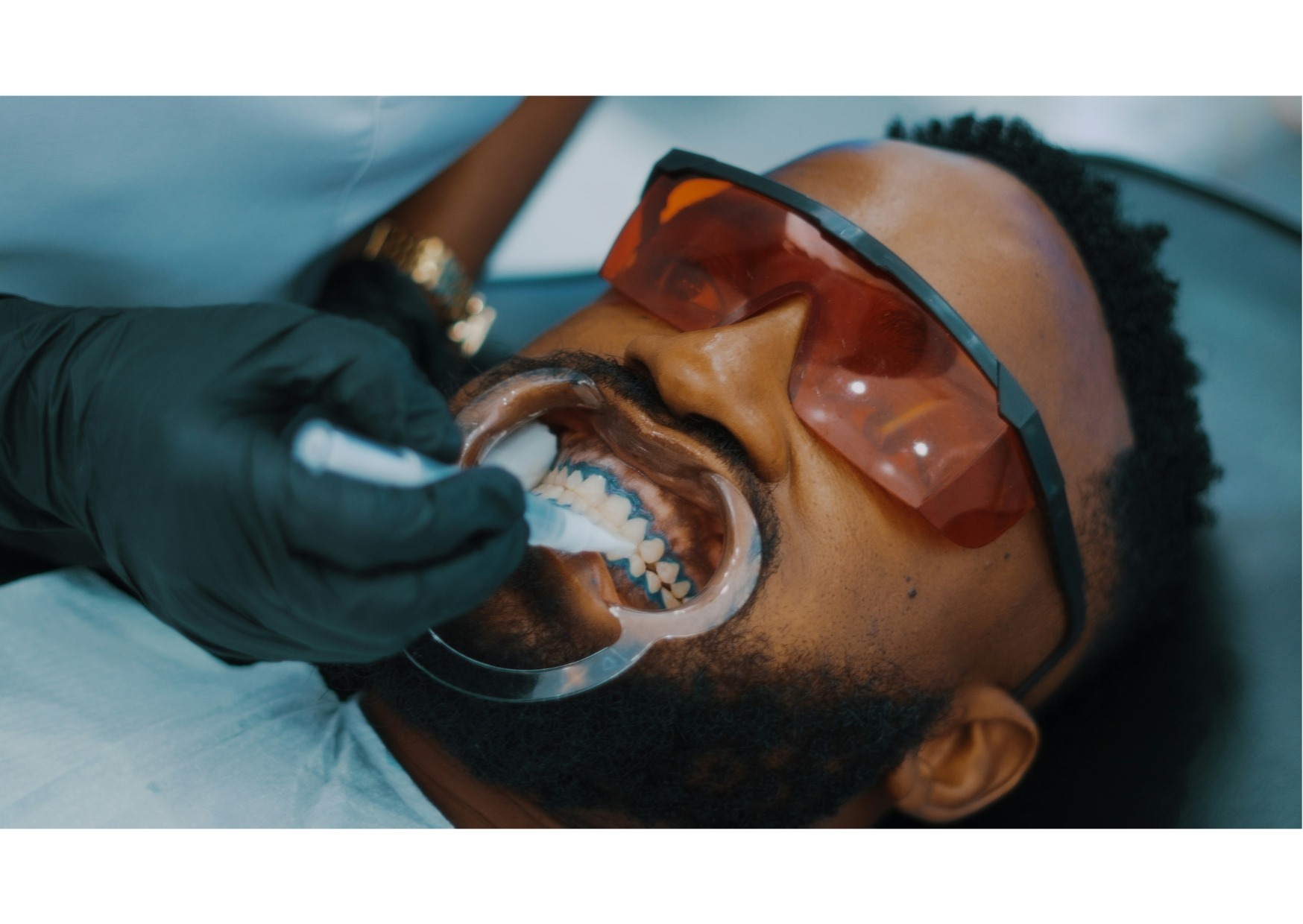 Patient receiving dental treatment on front teeth.