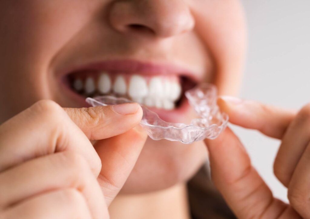 Person holding a custom clear nightguard before wearing it to help protect teeth from nighttime grinding and clenching.