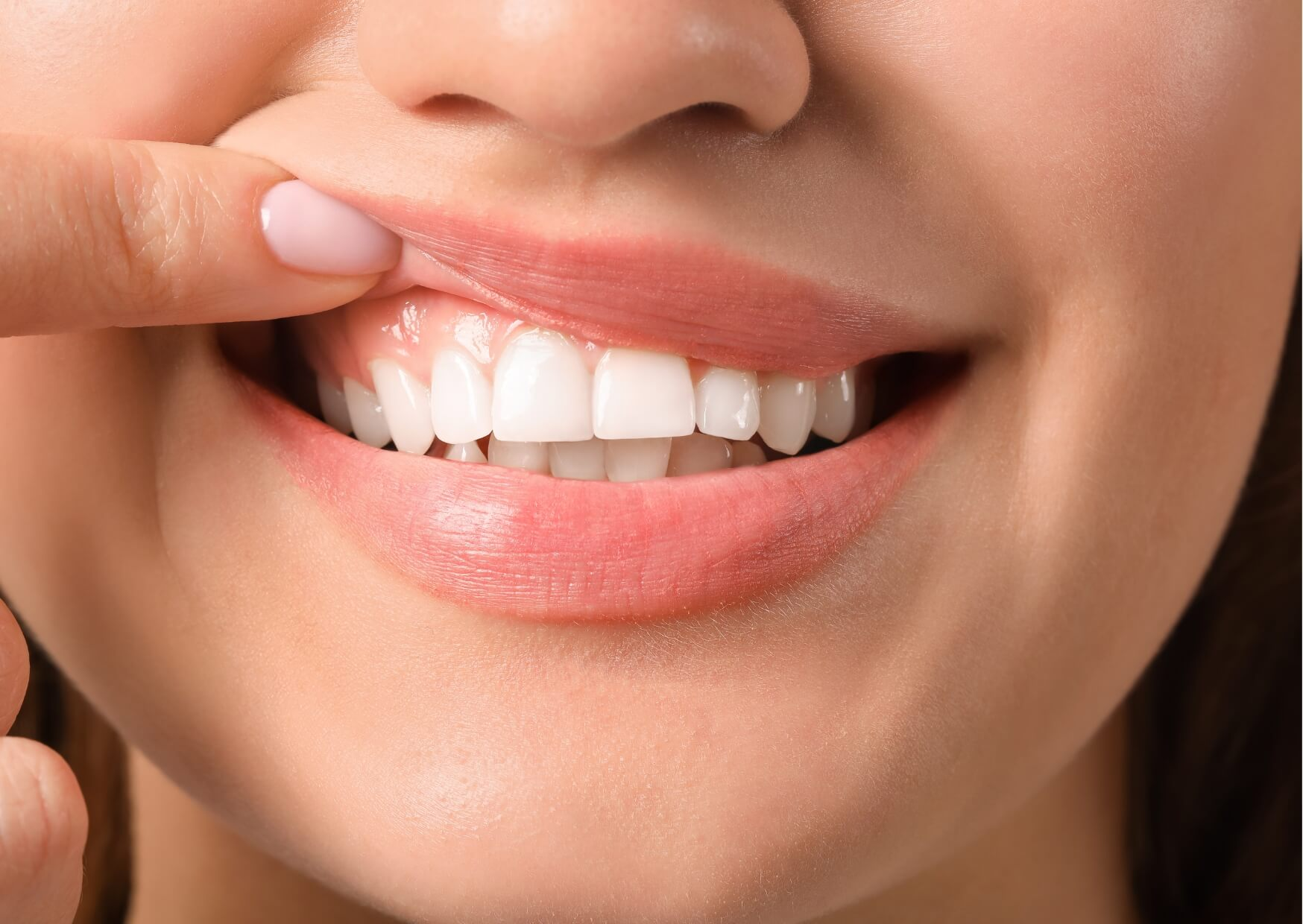 Close-up of healthy, even gums and teeth illustrating the cosmetic results that gum contouring can achieve.