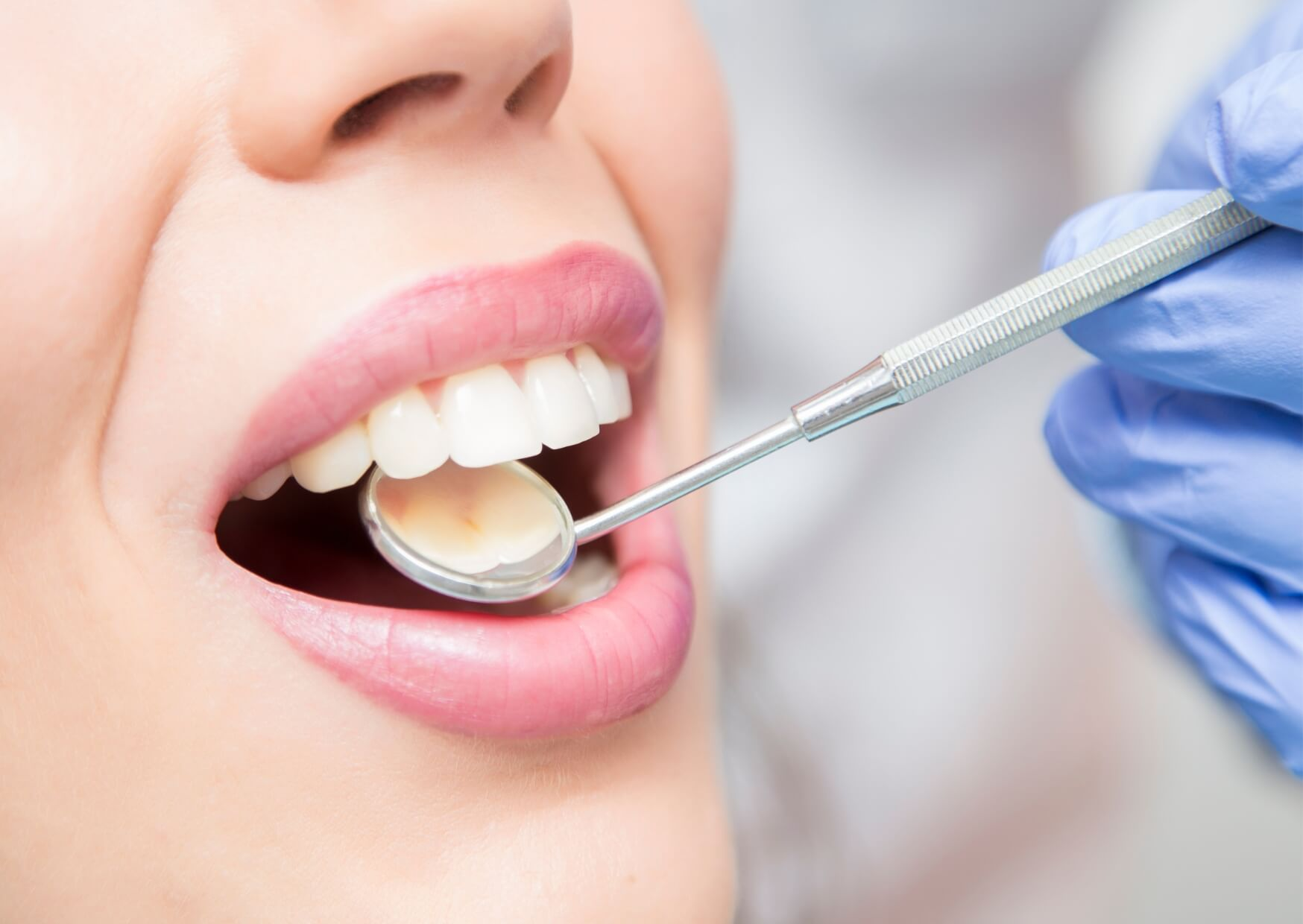 Close-up of a dentist examining front teeth before cosmetic bonding, highlighting a consultation about how much teeth bonding costs.